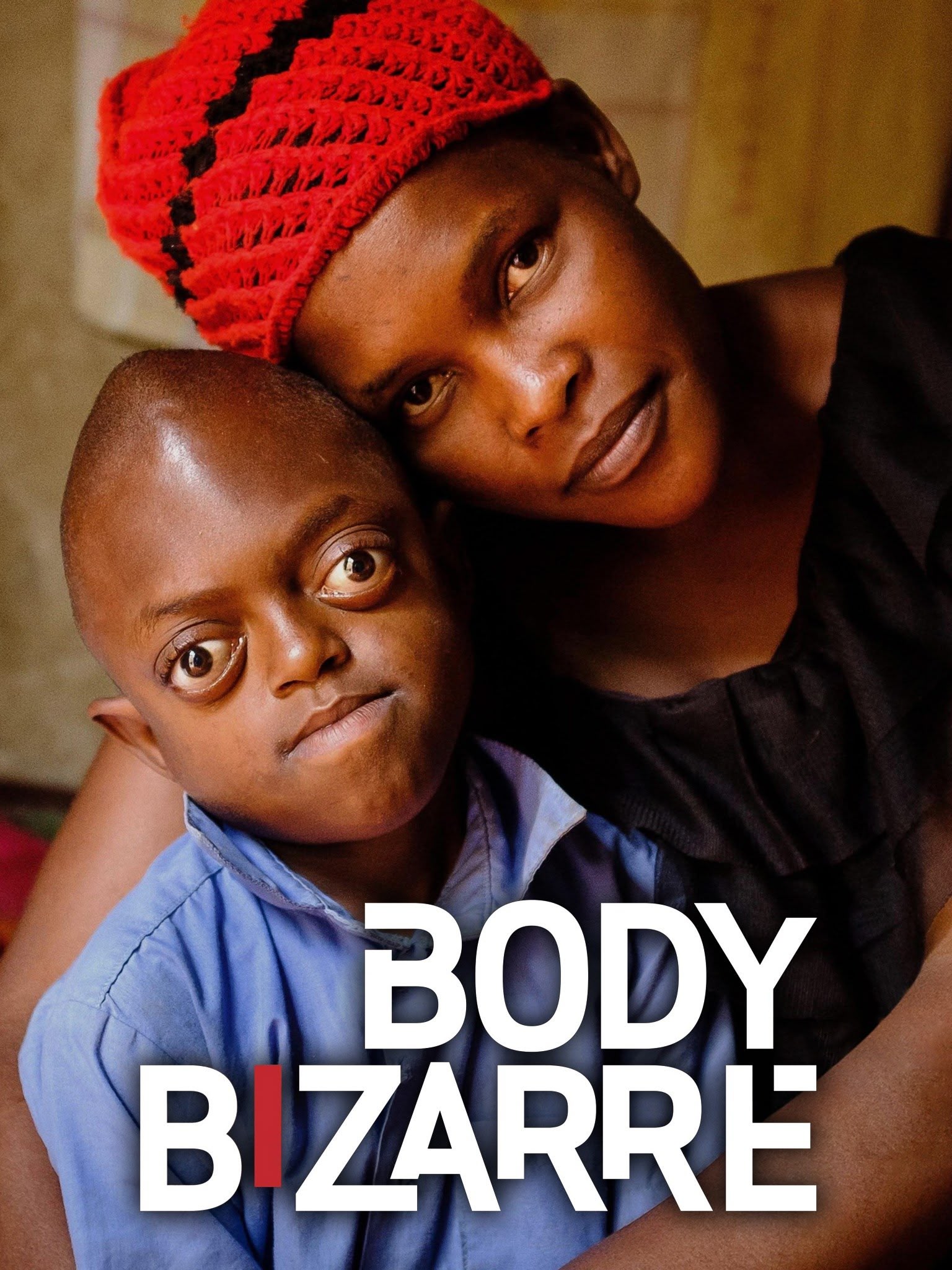 Boy With No Jaw: Body Bizarre